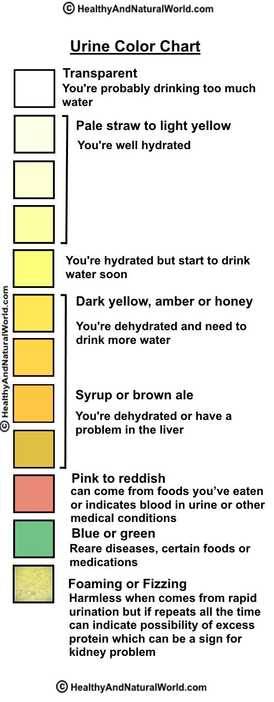 printable urine color chart